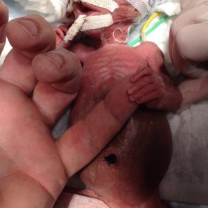 Cirurgia Neonatal